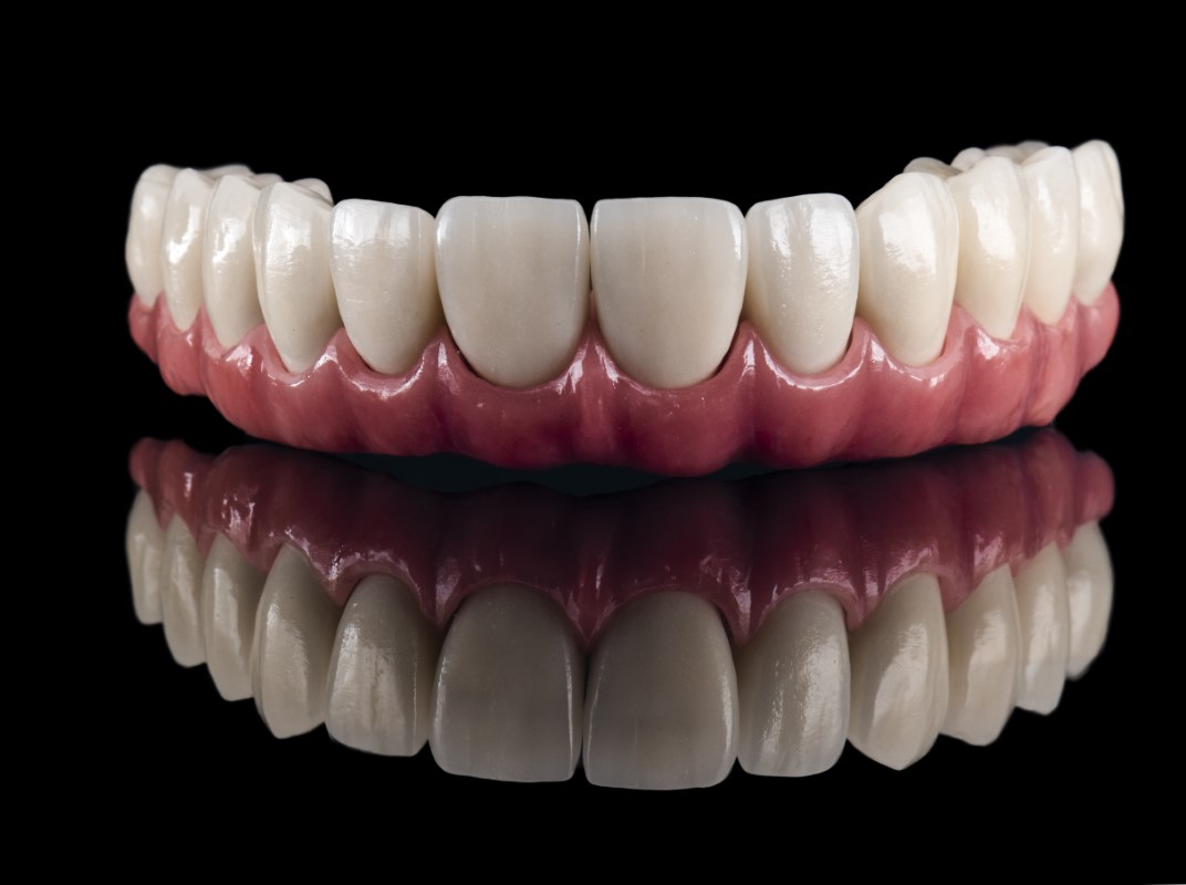 Grafik Implantat