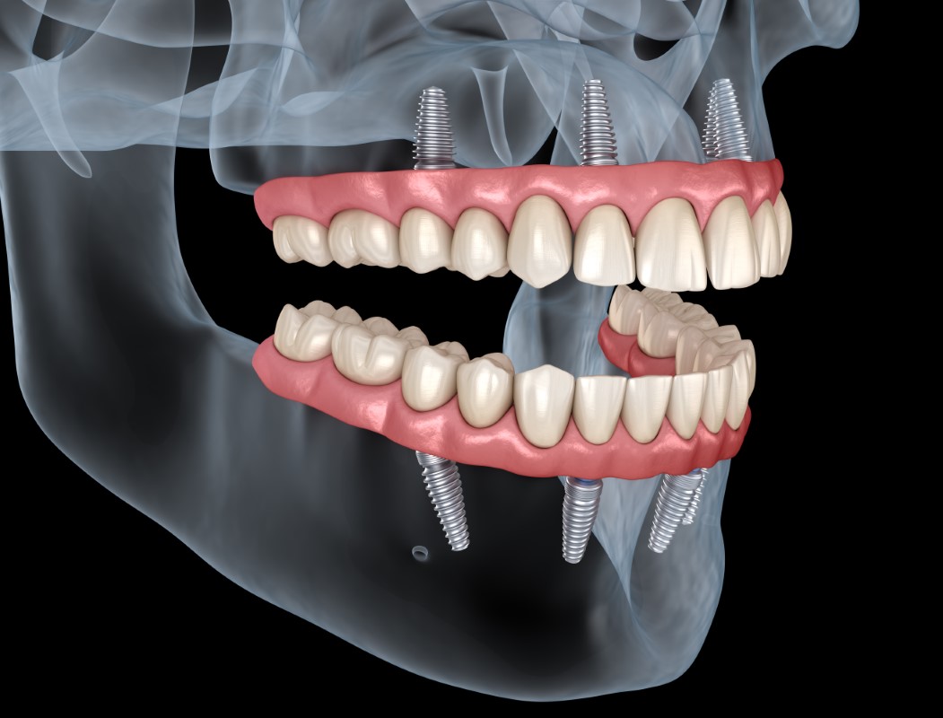 Implantatzentrum Marl